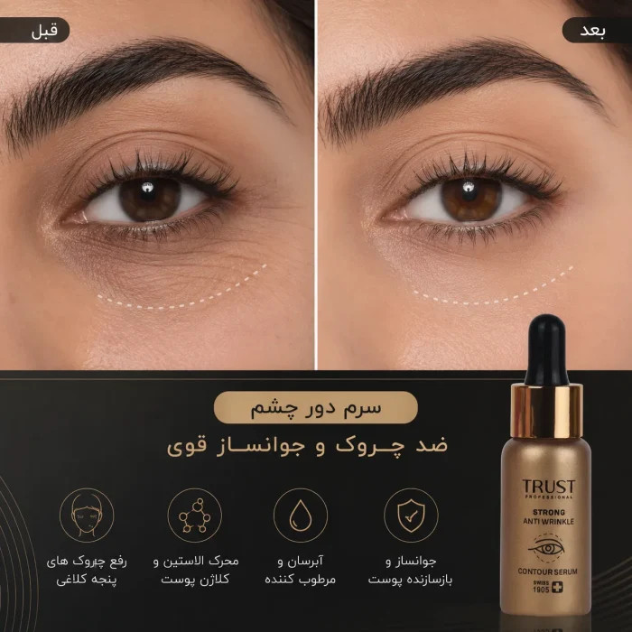 سرم ضدچروک دور چشم تراست
