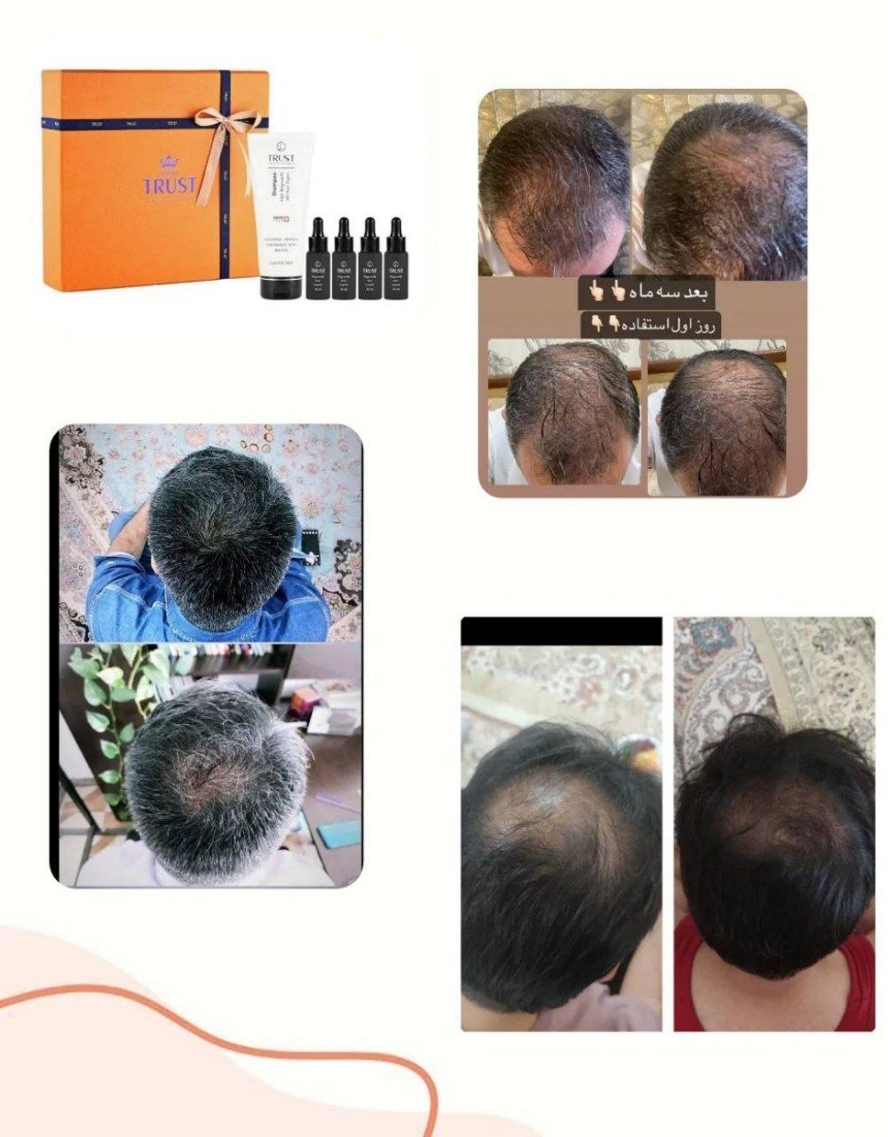 کیت تخصصی رویش مجدد